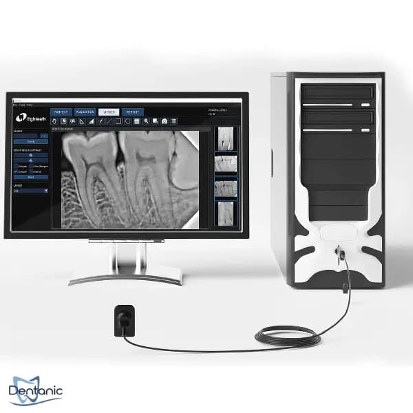 سنسور RVG ایتیس Eighteeth مدل Nanopix — تصویر ۳