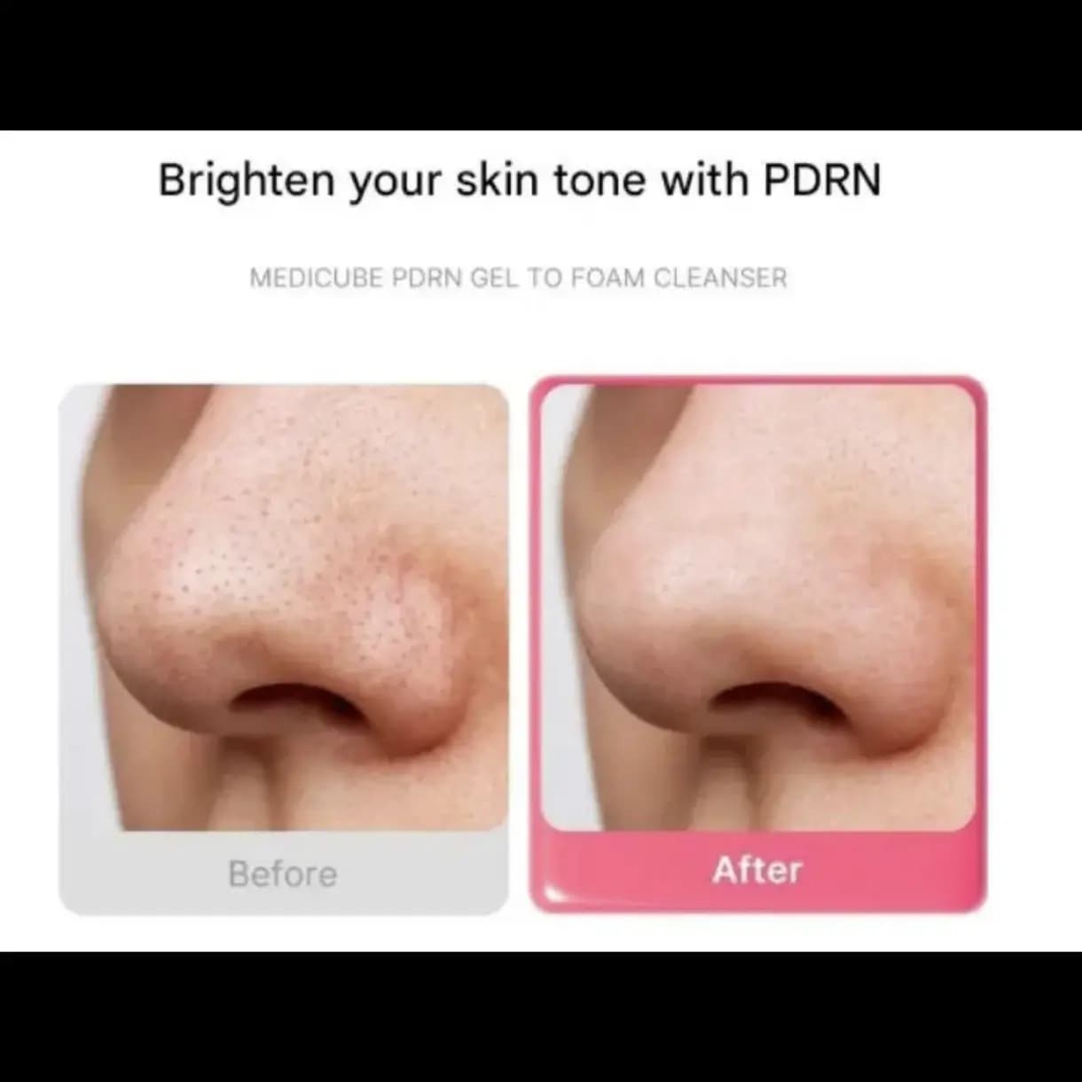 ژل شستشوی آبرسان PDRN مدی کیوب 200 میل — تصویر ۳
