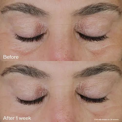 کرم دور چشم ژاپنی شاداب کننده و سفت کننده Vital Perfection — تصویر ۷
