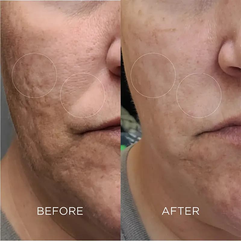 اسکراب لایه بردار صورت دکتر برنت Dr.Brandt — تصویر ۳