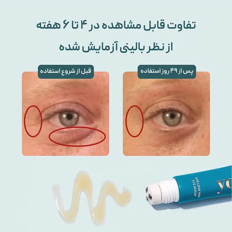 سرم دور چشم رولی یورز Yours — تصویر ۷