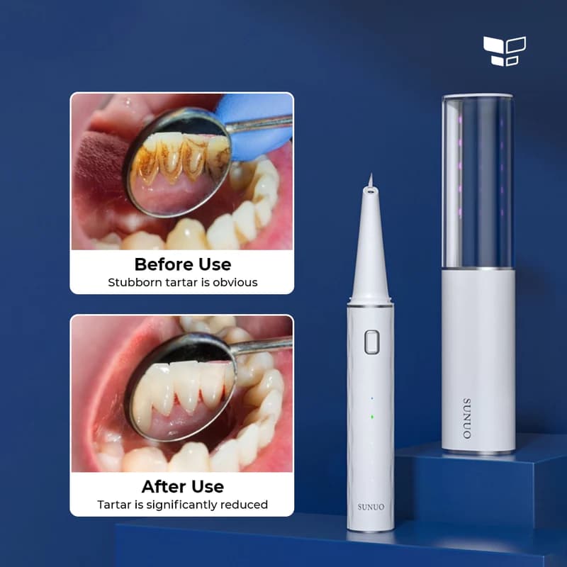 جرم گیر دندان هوشمند شیائومی Xiaomi Sunuo T12 Pro Ultrasonic Dental Scaler — تصویر ۴