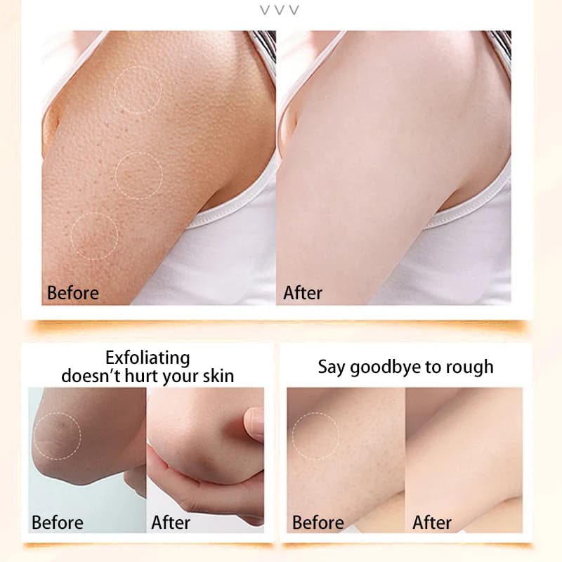 صابون کوجیک اسید روشن کننده قوی پوست صورت و بدن (روشون) — تصویر ۲