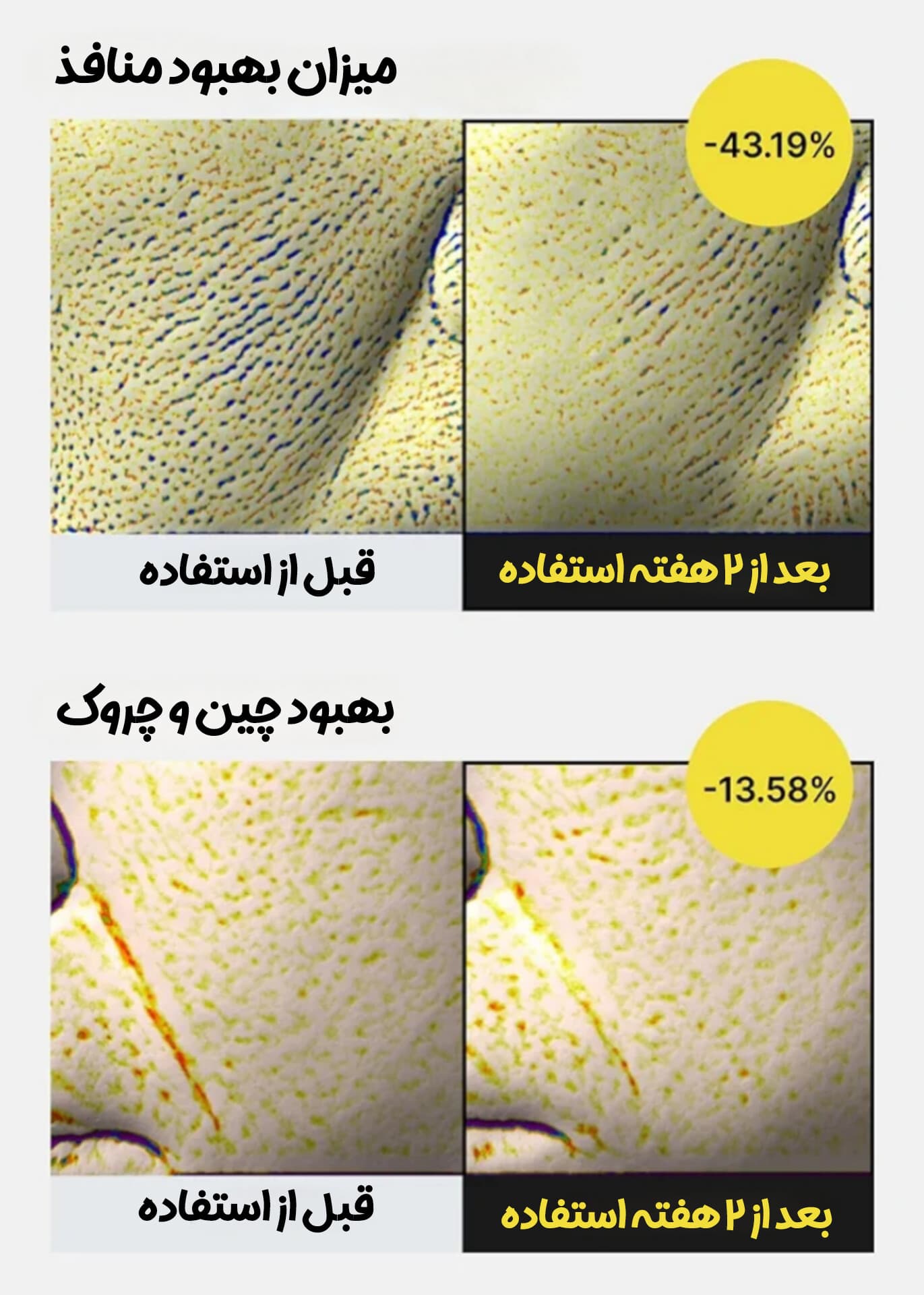 سرم ضد چروک رتینول شات سلیمکس — تصویر ۲