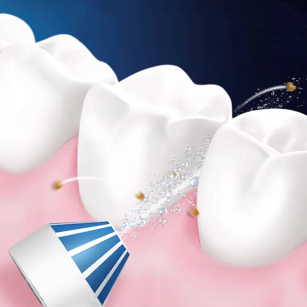 واتر جت دندان اورال-بی مدل MD20 اکسی جت — تصویر ۶