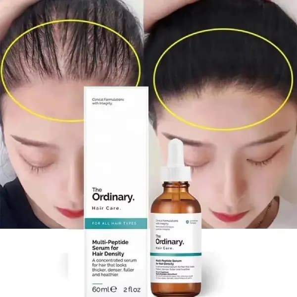 سرم مولتیپپتاید افزایش تراکم مو اوردینری The Ordinary | محلول تقویت و افزایش تراکم مو — تصویر ۲