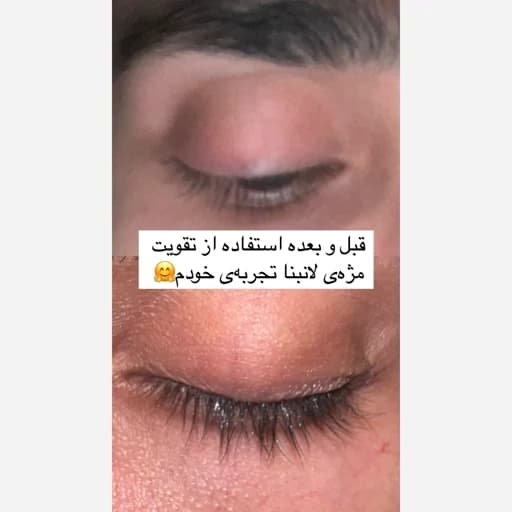 لوسیون تقویت مژه اصل اورجینال سرم تقویتی مژه ها و ابرو پرپشت کننده ضد ریزش بلند کننده ضخیم کننده مژه ها و ابرو ها چشم — تصویر ۸