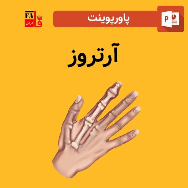 پاورپوینت آرتروز — تصویر ۲