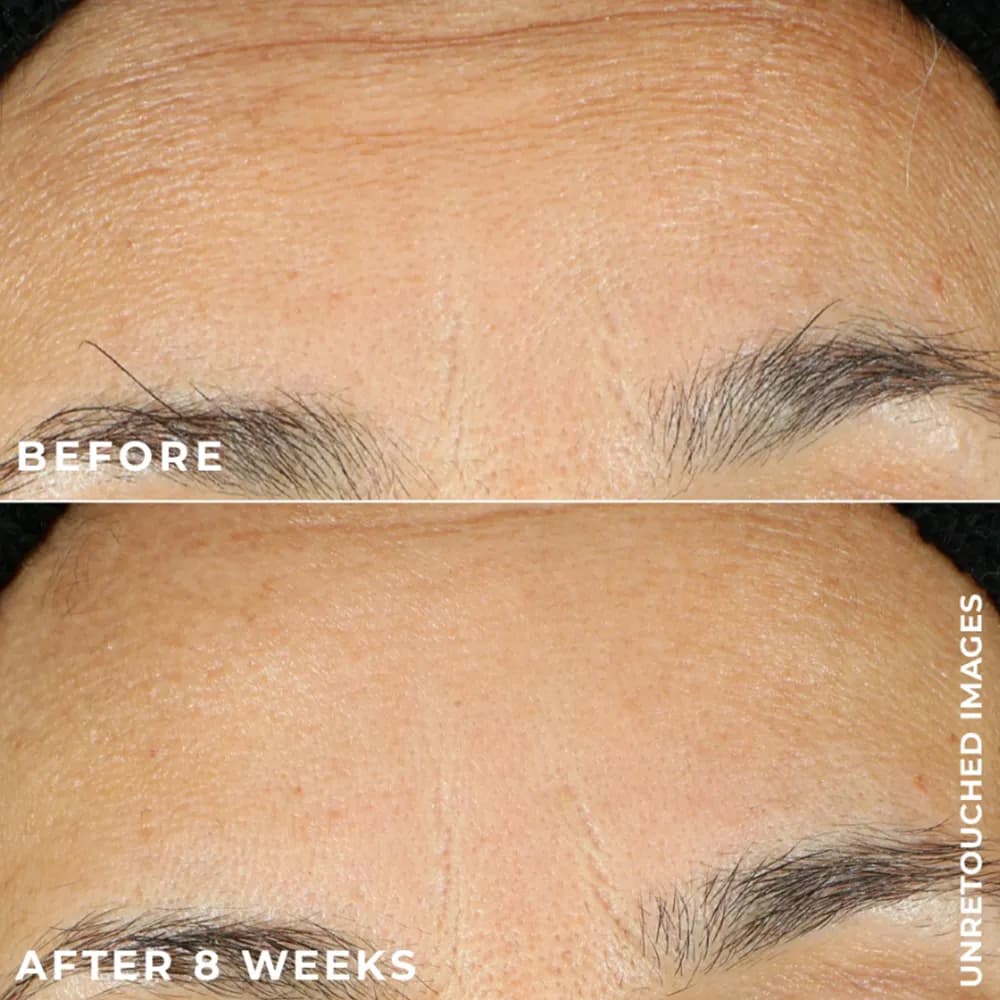 سرم کپسولی رتینول شب راک Roc ضد چین و چرک مناسب مبتدی RoC Retinol Correxion آمریکا اورجینال — تصویر ۸