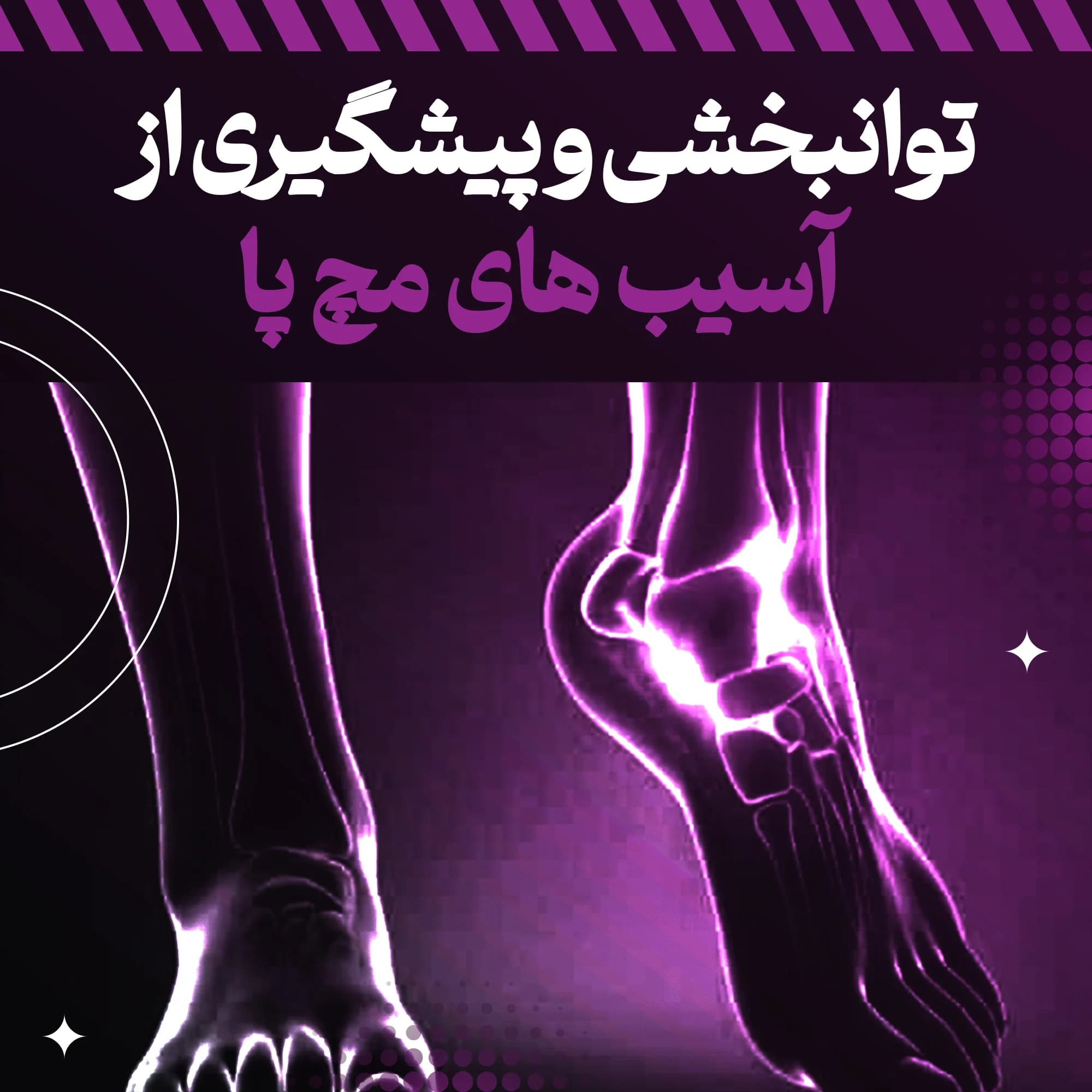 پکیج بازتوانی و پیشگیری آسیبهای مچ پا