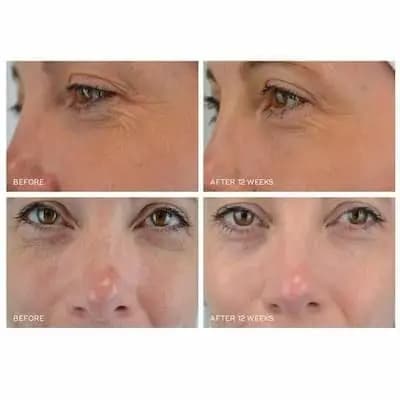 کرم دورچشم رتینال مدیک ایت Medik8 شماره 6 — تصویر ۵