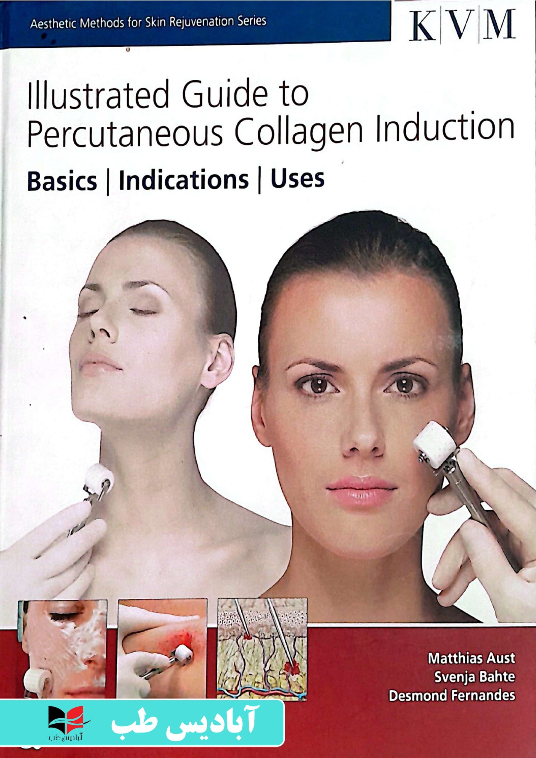Illustrated Guide to Percutaneous Collagen Induction: Basics / Indications / Uses (Aesthetic Methods for Skin Rejuvenation) 1st Edition | راهنمای مصور برای القای کلاژن از راه پوست: مبانی / موارد مصرف
