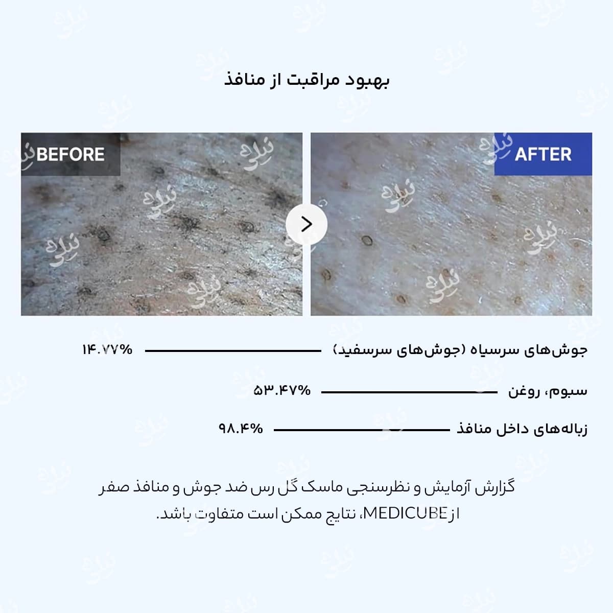 ماسک ضدجوش سرسیاه مدی کیوب – رفع منافذ تضمینی — تصویر ۳