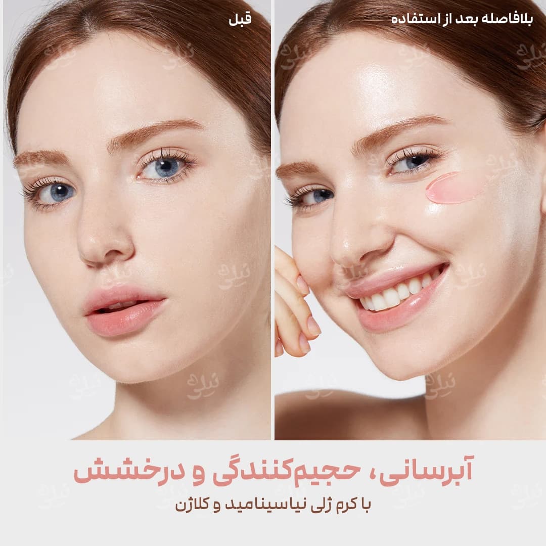 ژل کرم کلاژن نیاسینامید مدی کیوب: روشن کننده و جوانساز — تصویر ۶