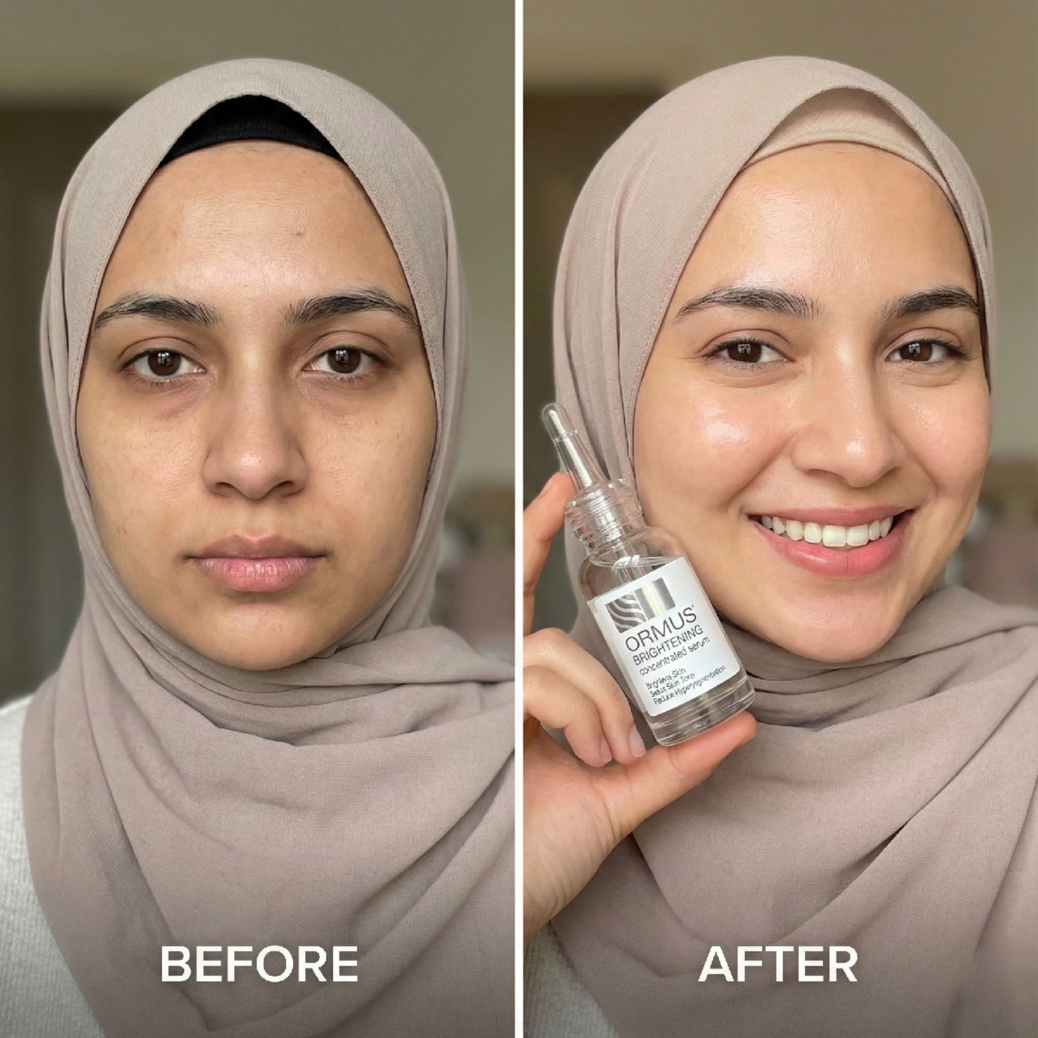 سرم آلفا آربوتین اورموس | رفع تیرگی و روشن کننده پوست — تصویر ۴