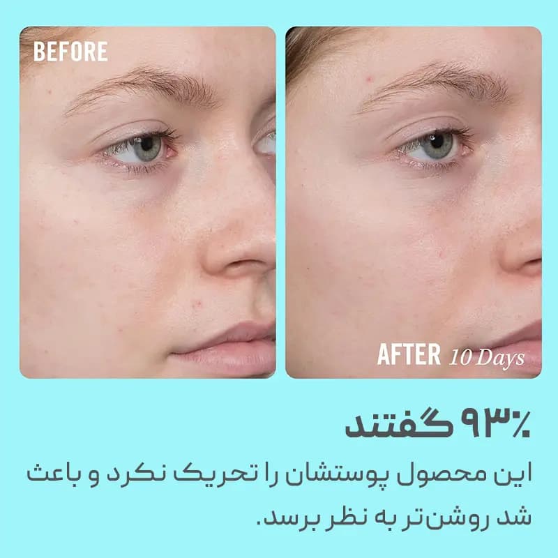 سرم ویتامین سی فرست اید بیوتی First Aid Beauty — تصویر ۲