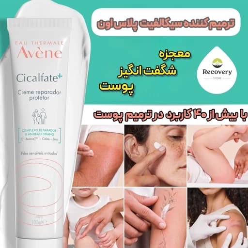 کرم ترمیم کننده پوست جای جوش و سوختگی و لک و زخم حجم 100 میل (اورجیینال) — تصویر ۵