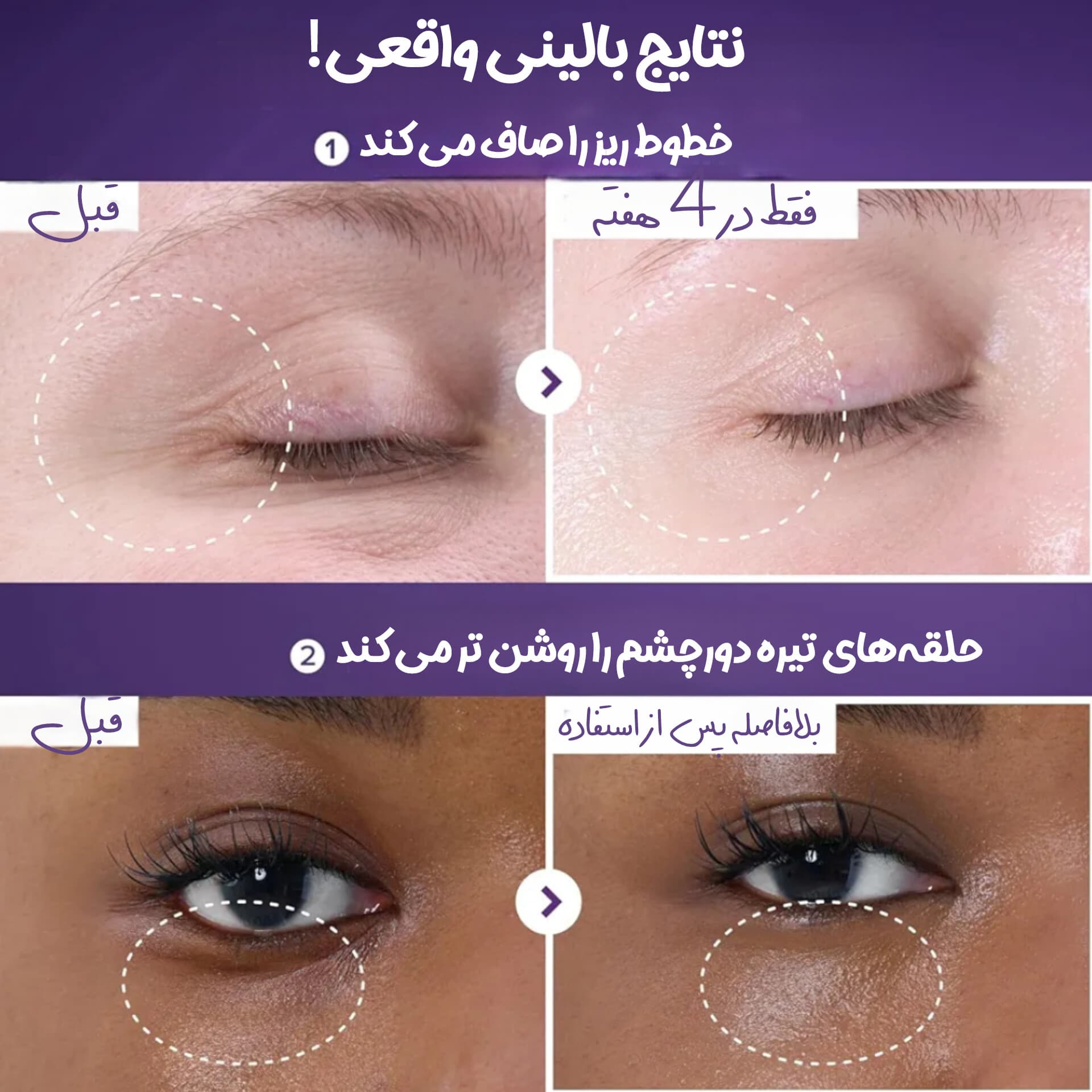 کرم دورچشم ضد چروک رتینول شماره 9 نامبوزین — تصویر ۶