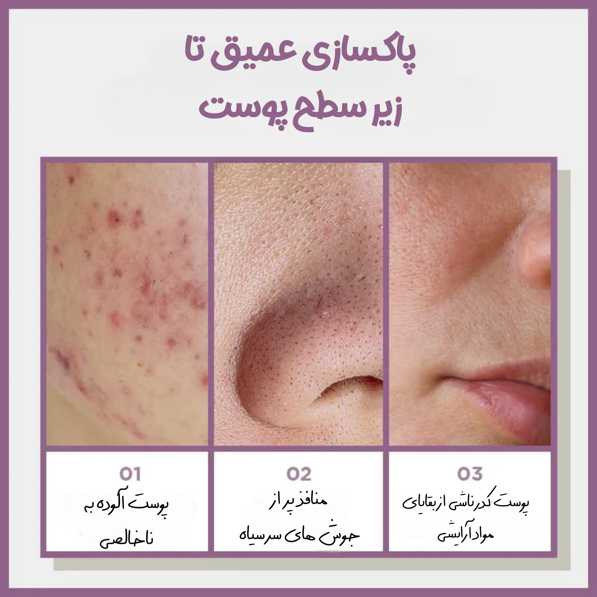 ماسک صابونی پیله ابریشمی زامبی بیوتی اسکین1004 — تصویر ۳