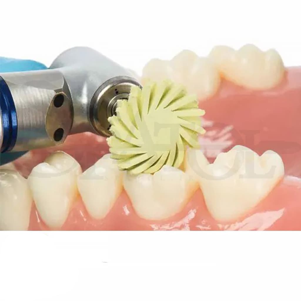 دیسک خورشیدی کامپوزیت Jiffy Natural composite system spiral wheel Medium برند الترادنت Ultradent — تصویر ۲