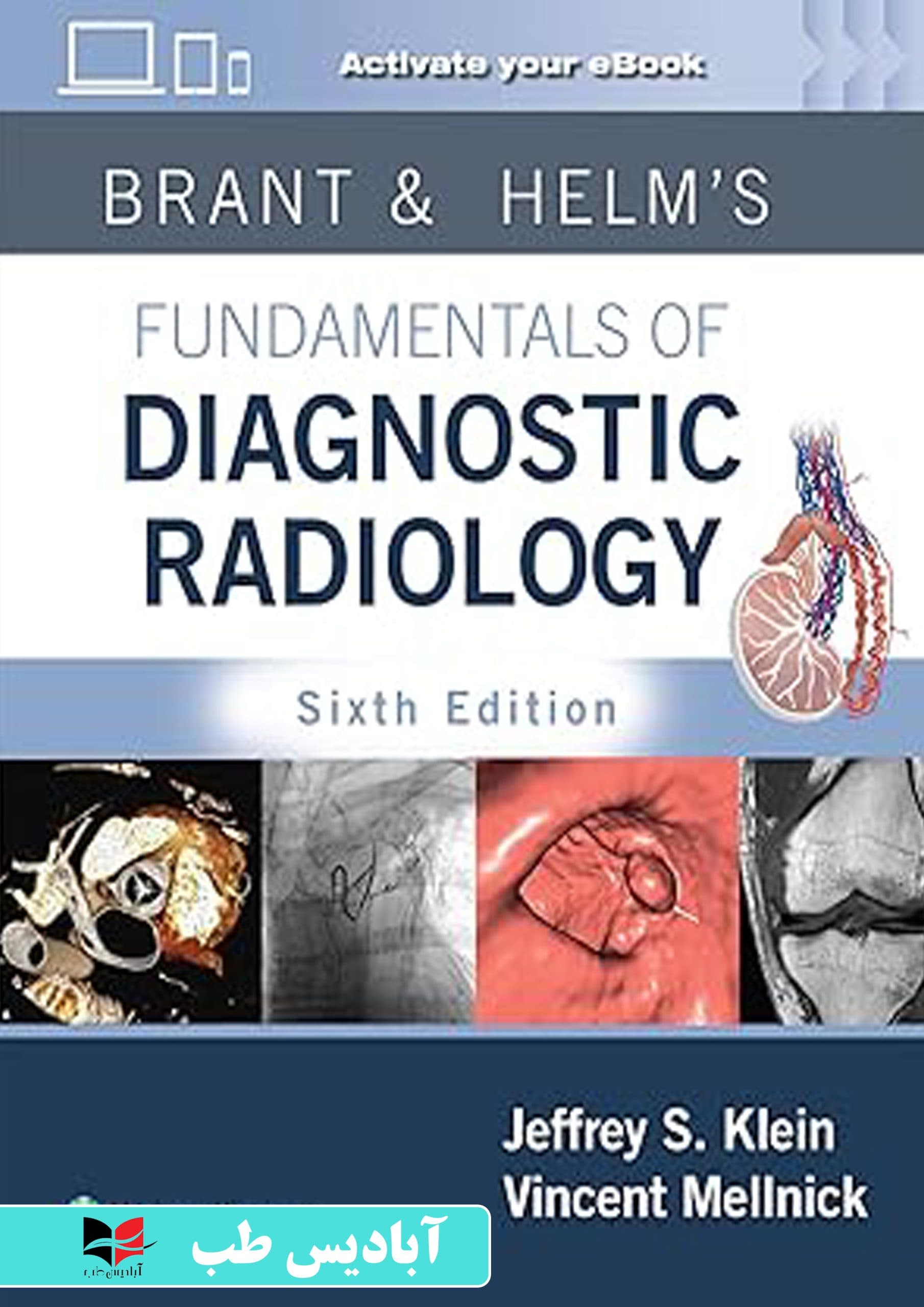 Brant & Helms Fundamentals of Diagnostic Radiology:Sixth Edition | برانت و هلمز مبانی رادیولوژی تشخیصی: ویرایش ششم | رادیولوژی برنت 2025