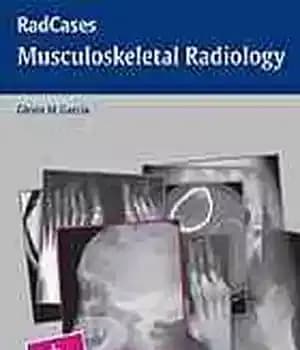 دانلود کتاب Musculoskeletal radiology – رادیولوژی عضلانی