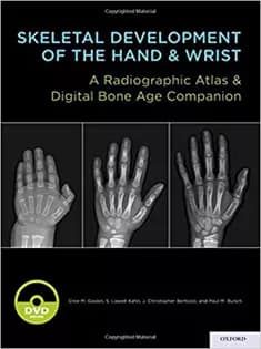 دانلود کتاب Skeletal Development of the Hand and Wrist