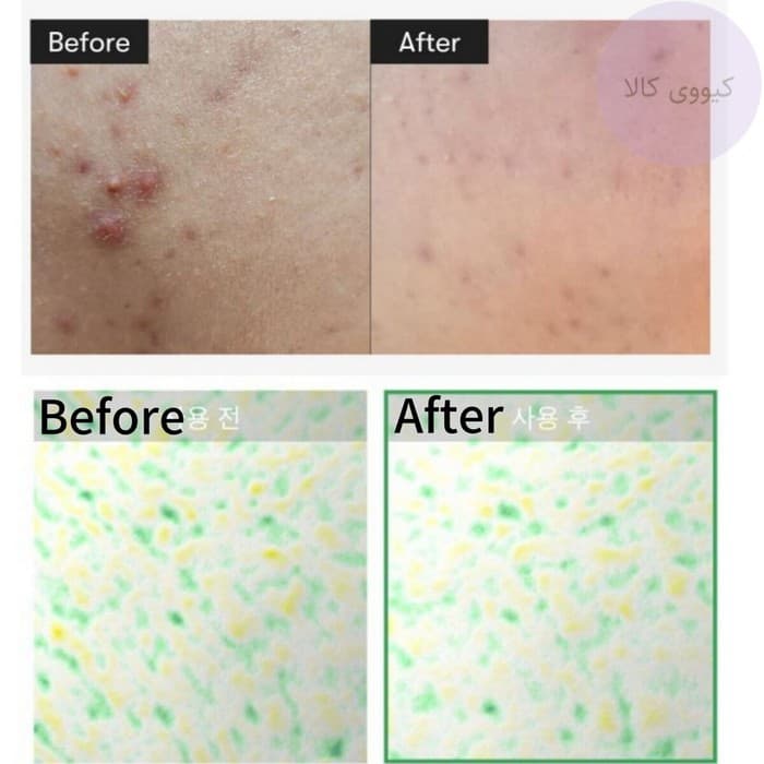 سرم ریدل شات 100 وی تی کازمتیک Vt Cosmetics اصل — تصویر ۴