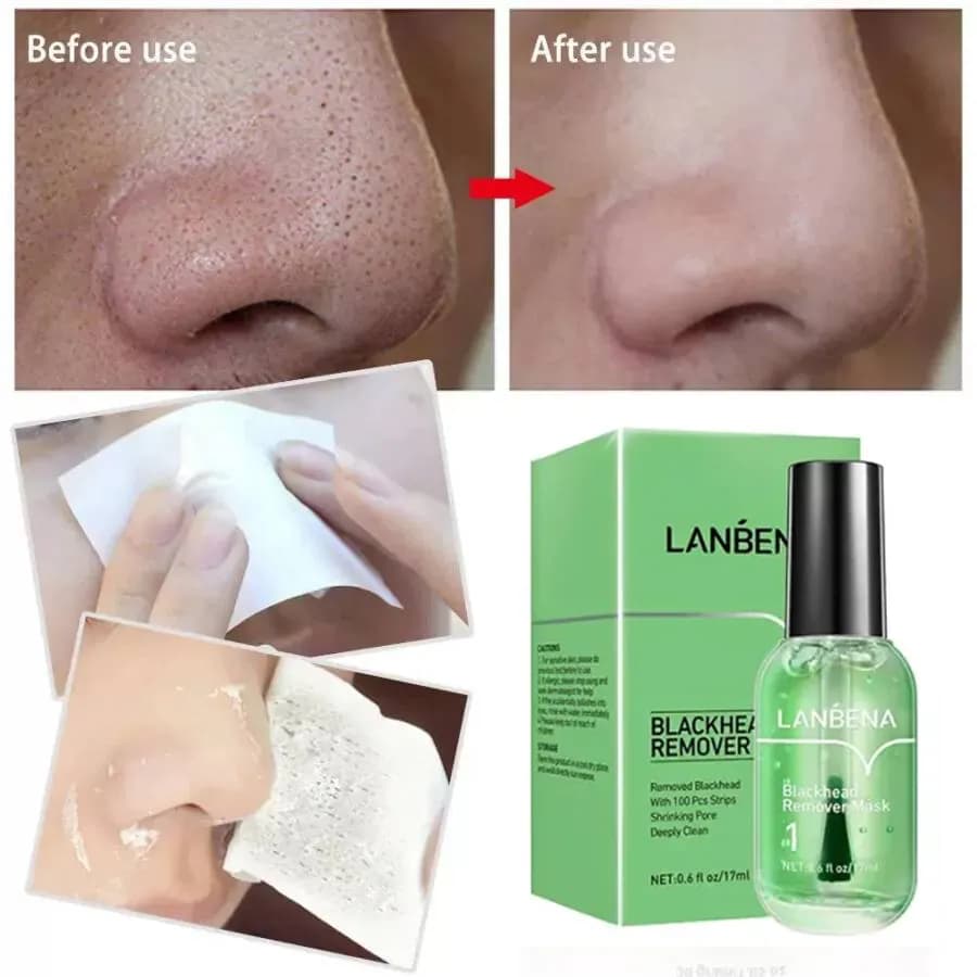 چسب بینی لانبنا LANBENA | حذف جوش سرسیاه و چربی بینی — تصویر ۳