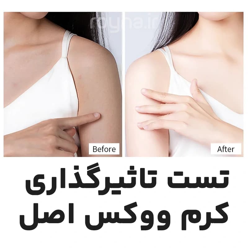کرم ووکس اصل حجم 100 میلی لیتر (سفید کننده فوری پوست) — تصویر ۴