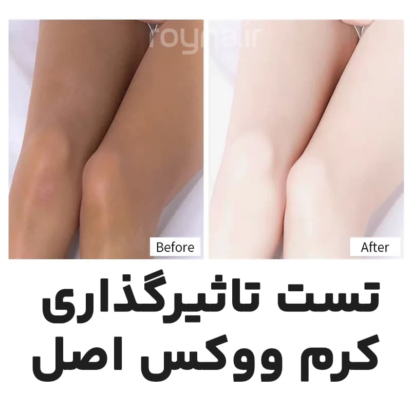 کرم ووکس اصل حجم 100 میلی لیتر (سفید کننده فوری پوست) — تصویر ۳