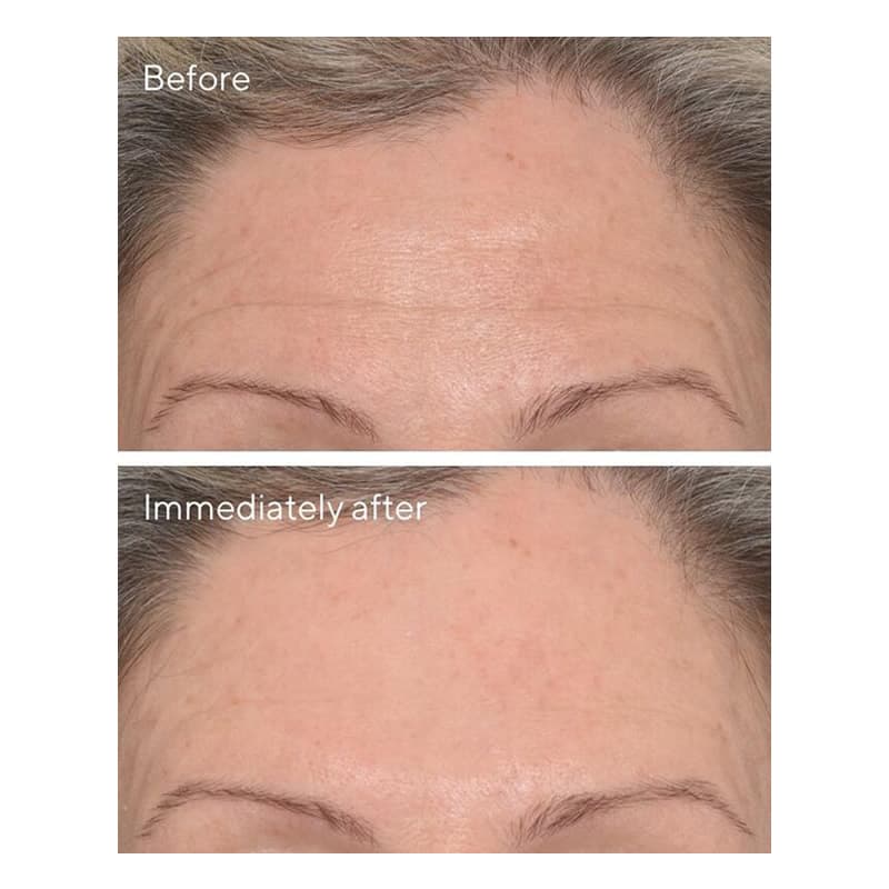 کرم دور چشم پر کننده خطوط دکتر مورد Dr. Murad Wrinkle Corrector — تصویر ۲