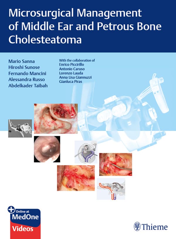 مدیریت میکروسرجیکال کلستئاتوم گوش میانی و استخوان پتروس ۲۰۱۹ <br> Microsurgical Management of Middle Ear and Petrous Bone Cholesteatoma 2019
