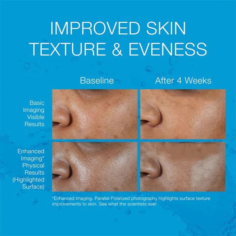 سرم آبرسان Neutrogena مدل Hydro Boost Hyaluronic Acid حجم 15 میلی لیتر — تصویر ۳