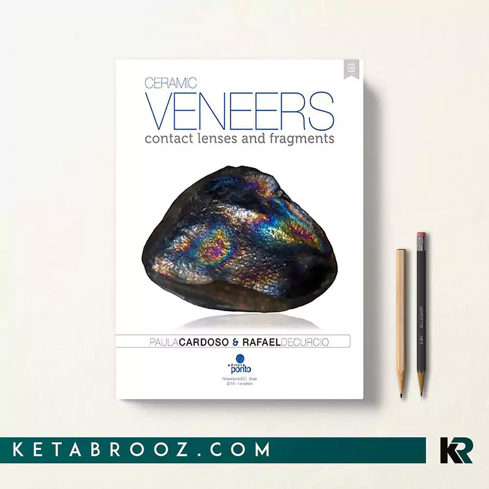 کتاب Ceramic veneers contact lenses and fragments