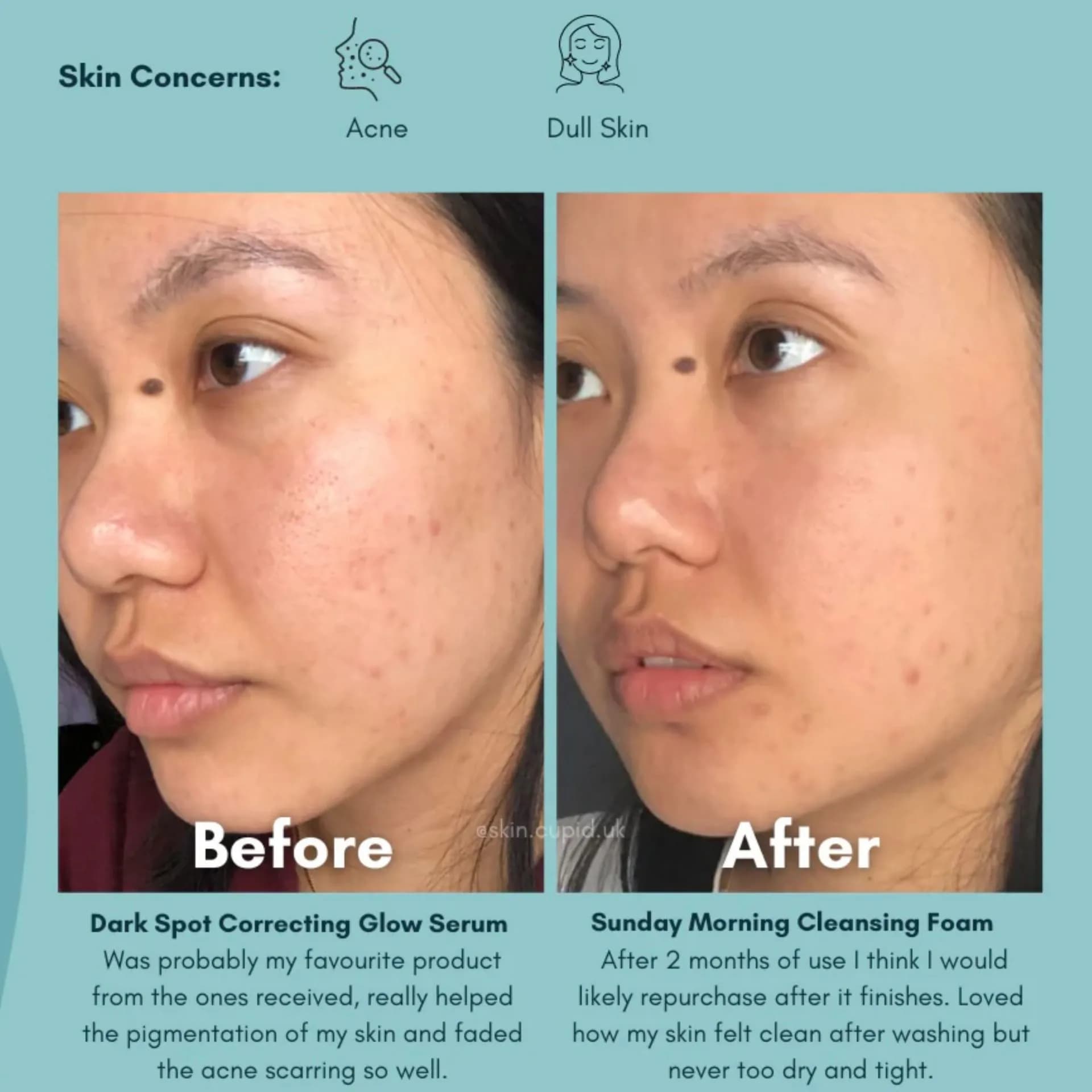 مرطوبکننده ضد لک و روشنکننده اکسیس وای AXIS-Y Dark Spot — تصویر ۳