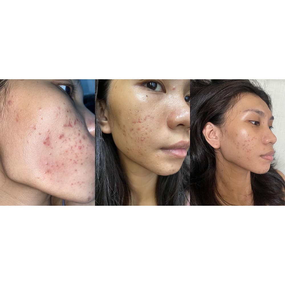 بوستر سرم تقویت کننده پپتید کوزارکس Cosrx the 6 peptide skin booster serum — تصویر ۲