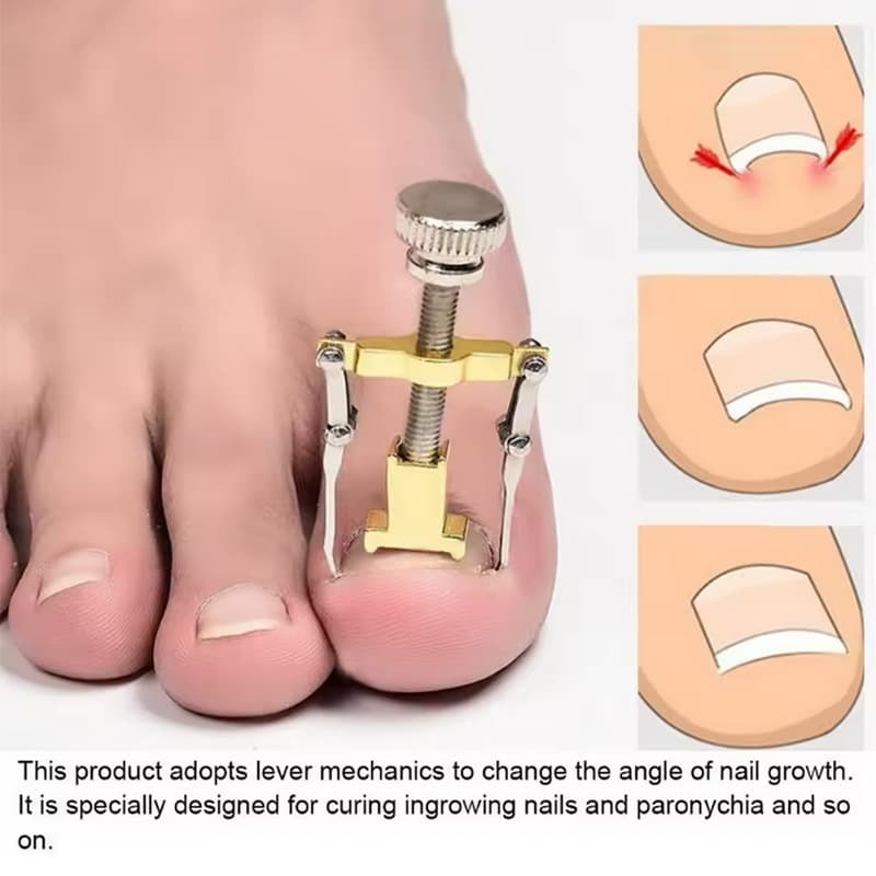 دستگاه اصلاح فرم و ارتودنسی ناخن مدل Nails کد433 — تصویر ۵
