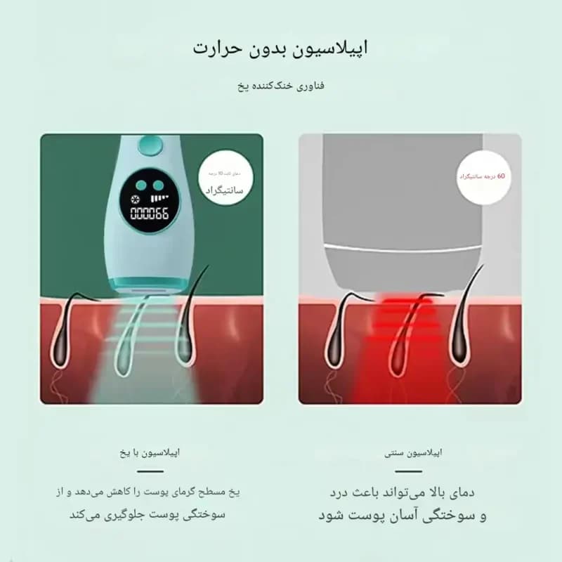 دستگاه لیزر موهای زائد خانگی 999999 شات IPL | حذف مو بدون درد با تکنولوژی یخ و عمر طولانی-فروش استثنائی — تصویر ۷