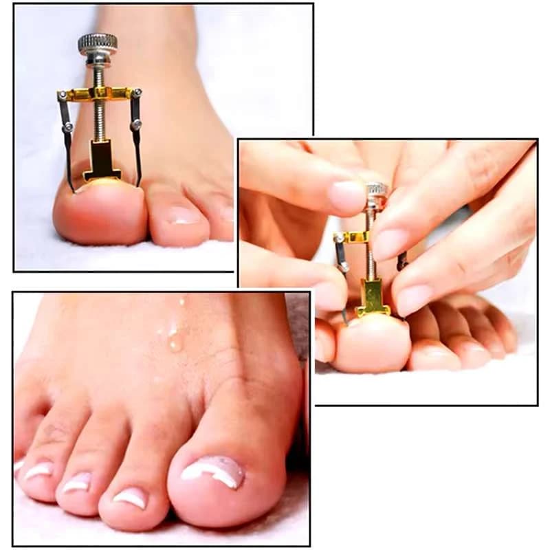 دستگاه اصلاح فرم و ارتودنسی ناخن مدل Nails کد N433 — تصویر ۶