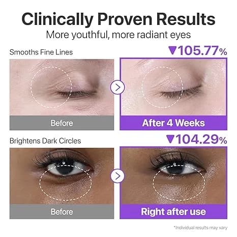 کرم دور چشم نامبوزین شماره ۹ NAD+ Retinol حجم ۱۰ میل — تصویر ۴