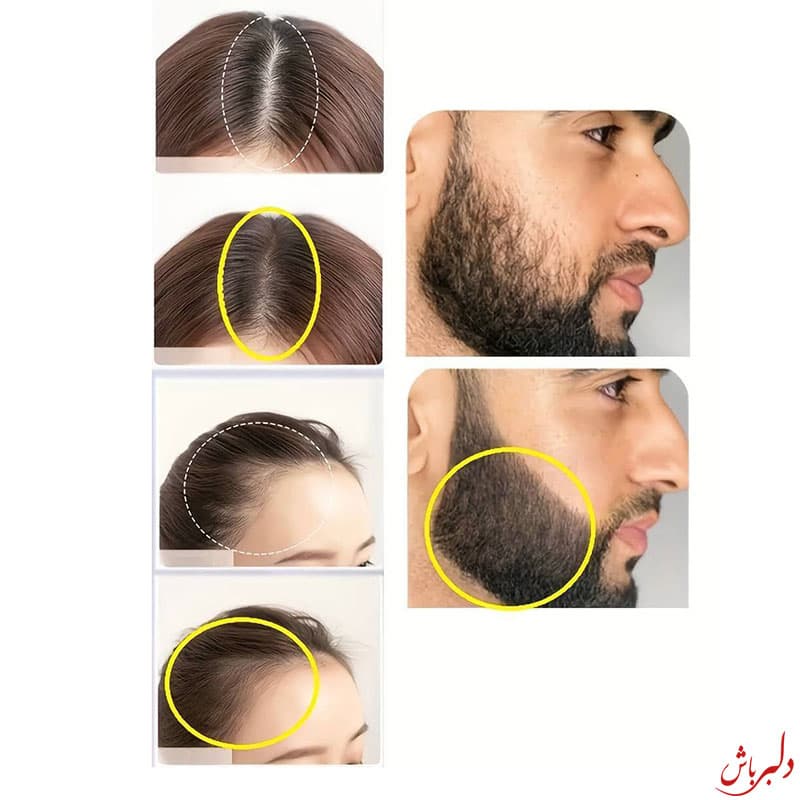 استامپ پرپشت کننده مو — تصویر ۵