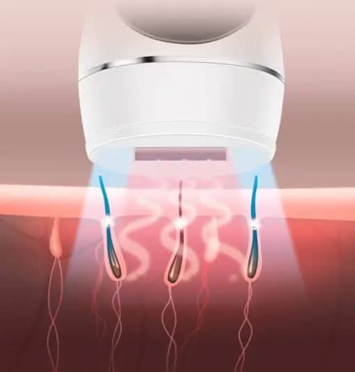 دستگاه لیزر اصلاح موهای بدن IPL Hair Removal MA01 — تصویر ۳