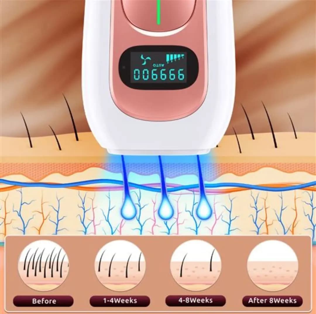 دستگاه لیزر اصلاح موهای بدن یک میلیون شات Aminzer – IPL Hair Removal Device PA2 — تصویر ۲