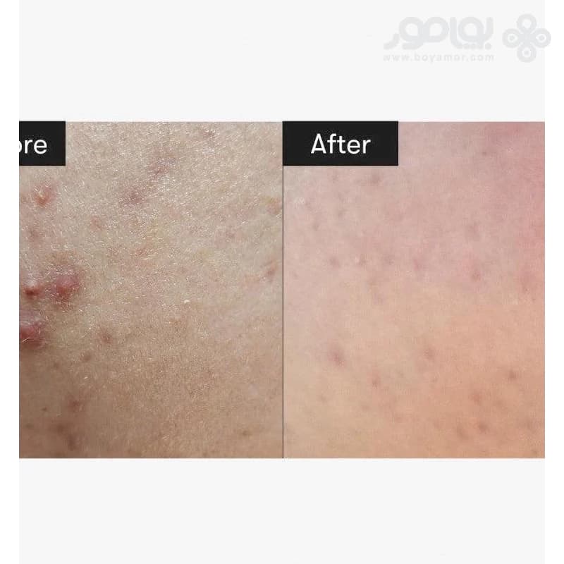 سرم ریدل شات 50 VT کازمتیک حجم 50 میل — تصویر ۴