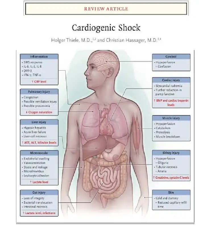 کتاب Cardiogenic Shock (شوک کاردیوژنیک) اثر هولگر تیله | نسخه انگلیسی PDF