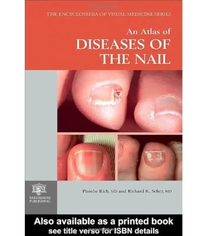 کتاب An Atlas of Diseases of the Nail (اطلس بیماریهای ناخن) اثر فیبی ریچ | نسخه انگلیسی PDF