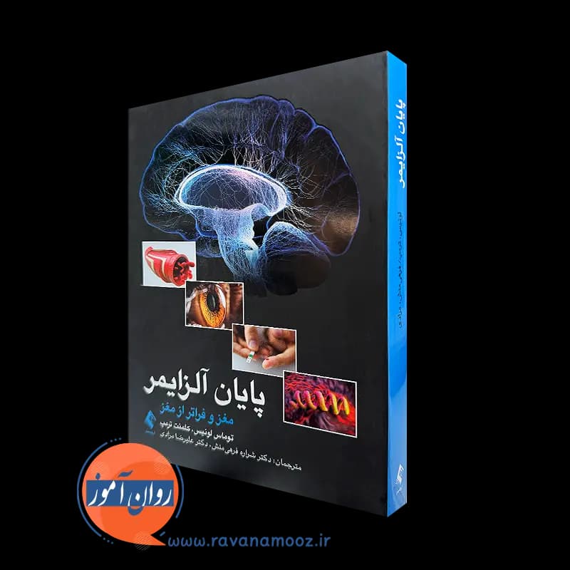 پایان آلزایمر؛ مغز و فراتر از مغز – توماس جی. لوئیس