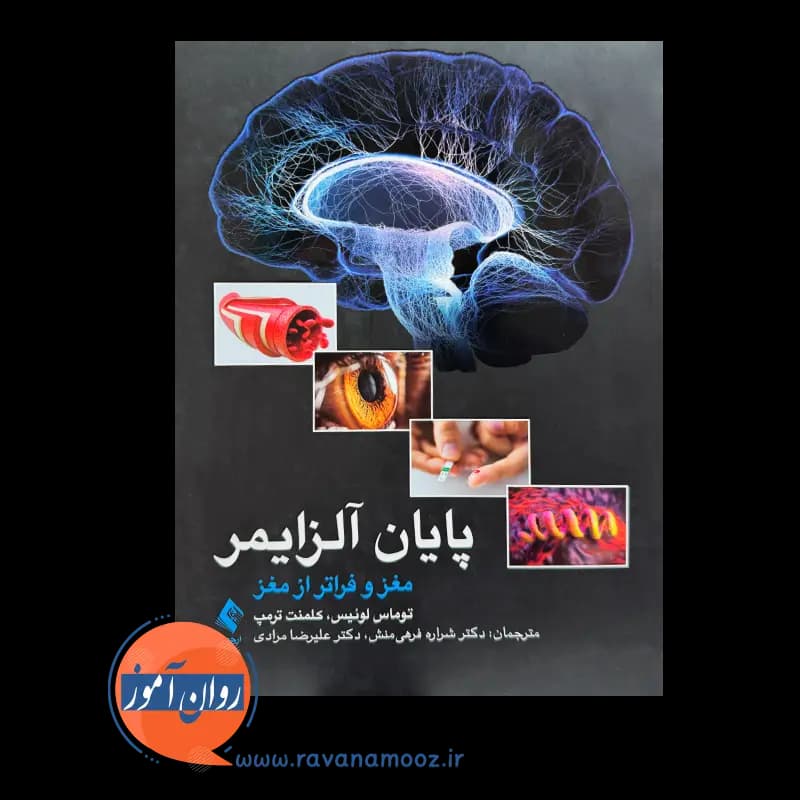 پایان آلزایمر؛ مغز و فراتر از مغز – توماس جی. لوئیس — تصویر ۲