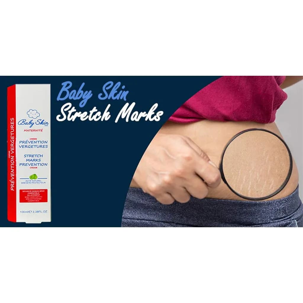 کرم ضد ترک بارداری 100میل بیبی اسکین Baby Skin — تصویر ۴